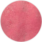 Erythrodermic Psoriasis